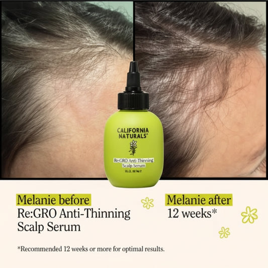 California Naturals Re:GRO Anti-Thinning Scalp Serum - 3 fl oz: Unscented, All Hair Types